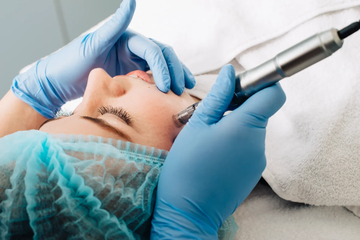 Advies van dermatoloog: laat gezichtsbehandeling uitvoeren door dermatoloog of huidtherapeut !